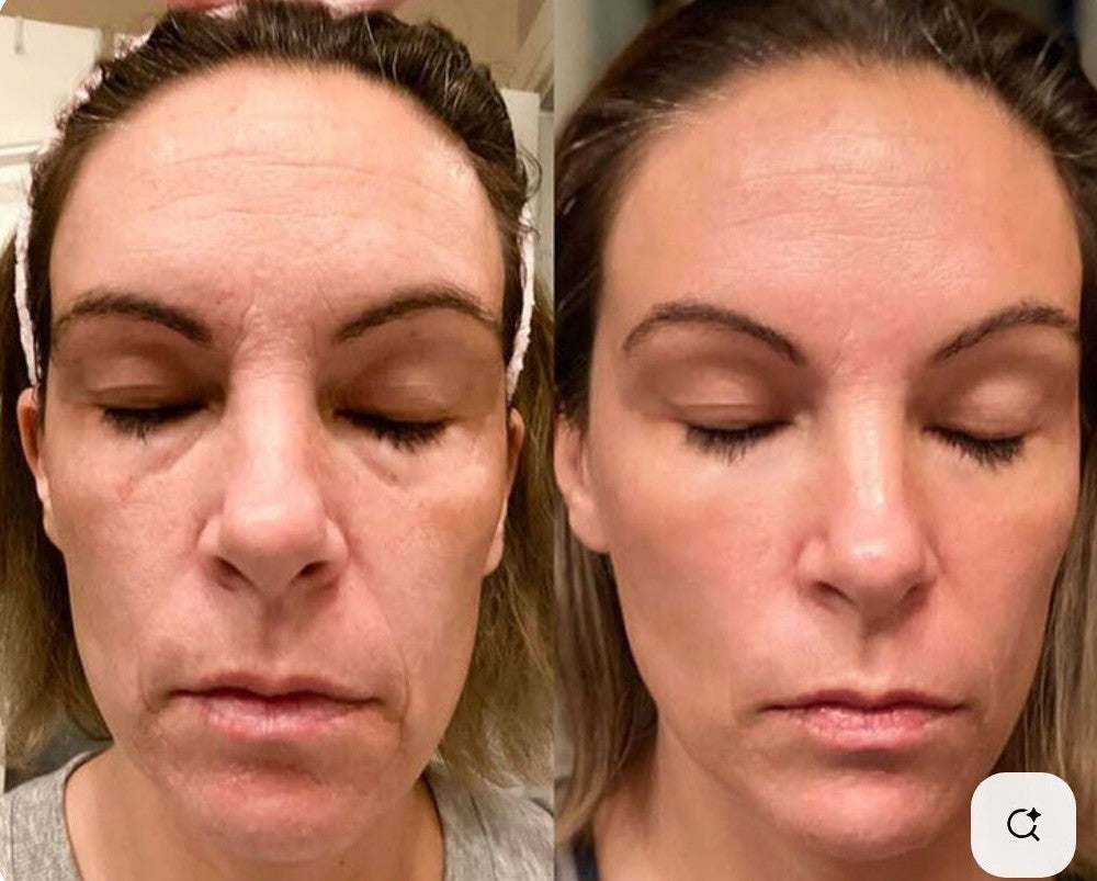 Louèlle Red Light Therapy Wand